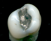 image tooth